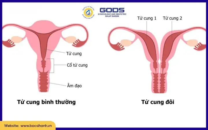 Bình Sa Lạc Nhạn: Khúc Nhạc Cổ Điển Trung Hoa Và Ý Nghĩa Sâu Sắc