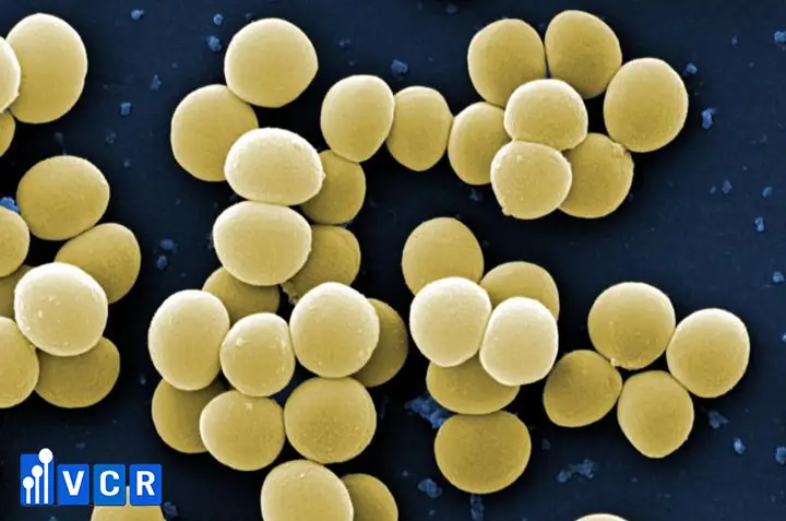 Bioburden Là Gì? Tại Sao Cần Kiểm Tra Và Tầm Quan Trọng Trong Sản Xuất Bioburden Là Gì? Tại Sao Cần Kiểm Tra Và Tầm Quan Trọng Trong Sản Xuất