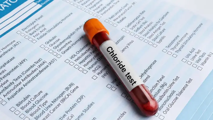 Blood Nghĩa Là Gì? Định Nghĩa, Ứng Dụng Và Các Thành Ngữ Liên Quan Đến "máu"