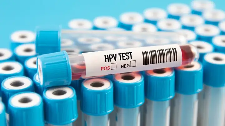 Blood Pos Là Gì? Ý Nghĩa Chỉ Số BLD (blood) Trong Xét Nghiệm Nước Tiểu