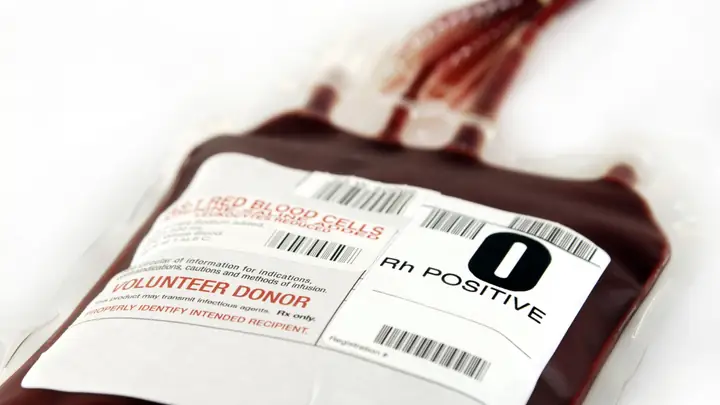 Blood Pos Là Gì? Ý Nghĩa Chỉ Số BLD (blood) Trong Xét Nghiệm Nước Tiểu