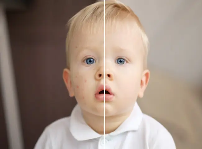 BMJ Là Gì? Định Nghĩa, Vai Trò Và Ứng Dụng Trong Y Khoa & Doanh Nghiệp