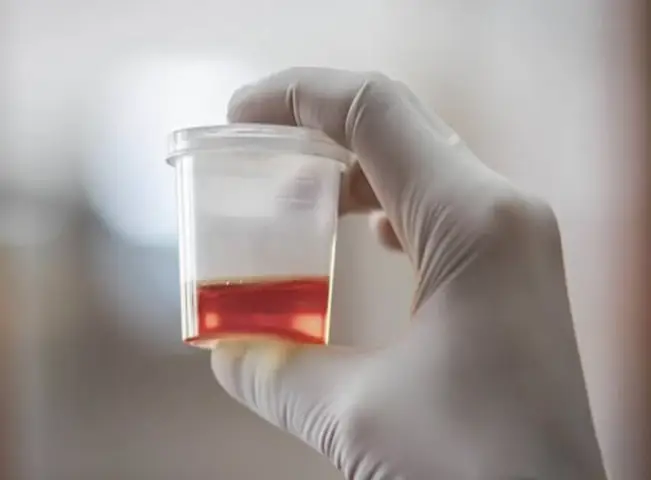 BMJ Là Gì? Định Nghĩa, Vai Trò Và Ứng Dụng Trong Y Khoa & Doanh Nghiệp