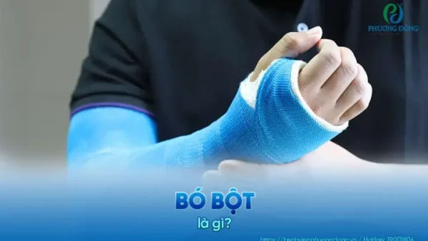 Bó Bột Là Gì? Tác Dụng, Quy Trình Và Lưu Ý Quan Trọng Khi Bó Bột