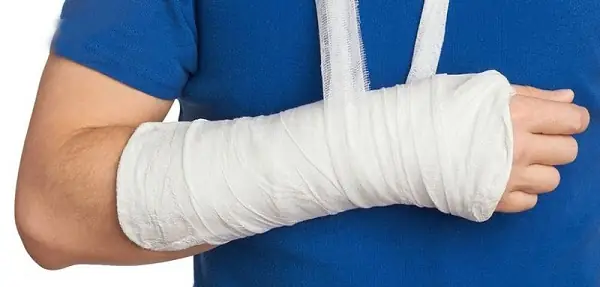 Bó Tay Là Gì? Ý Nghĩa, Cách Dùng Và Phân Biệt Với Các Tình Huống Tương Tự