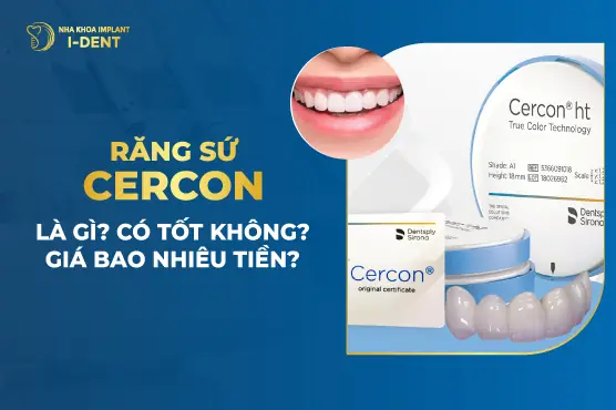Răng Sứ Cercon Là Gì? Ưu Điểm, Phân Loại & Chi Phí Bọc Răng Sứ Cercon