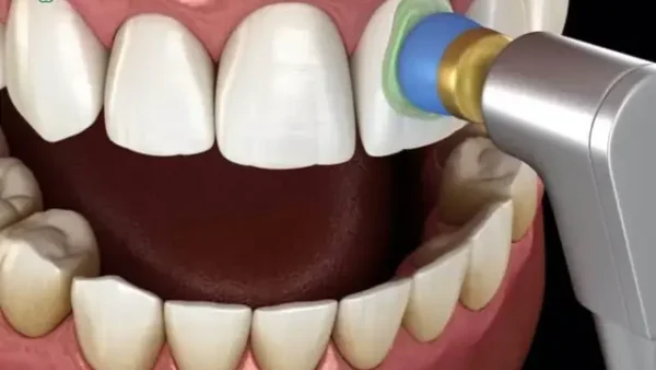 Bóng Trắng Là Gì? Giải Mã Hiện Tượng Bí Ẩn Theo Góc Nhìn Khoa Học & Tâm Linh