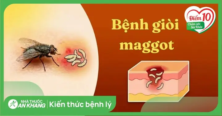 Botfly Maggot Là Gì? Đặc Điểm, Dấu Hiệu Nhiễm Trùng Và Cách Xử Lý