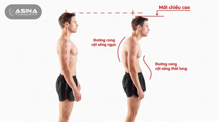 Đám Rối Thần Kinh Cánh Tay (brachial Plexus) Là Gì? Cấu Tạo, Chức Năng Và Các Vấn Đề Liên Quan