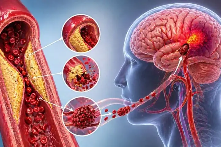 Brain Cell Là Gì? Khái Niệm, Chức Năng Và Các Loại Tế Bào Não