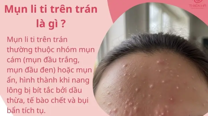 Bụi Hồng Trần Là Gì? Ý Nghĩa, Nguồn Gốc Và Cách Hiểu Đúng Trong Văn Hóa Bụi Hồng Trần Là Gì? Ý Nghĩa, Nguồn Gốc Và Cách Hiểu Đúng Trong Văn Hóa
