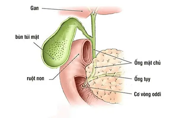 Bùn Túi Mật Là Gì? Nguyên Nhân, Triệu Chứng Và Dấu Hiệu Nhận Biết Sớm