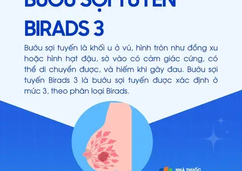 Bướu Sợi Là Gì? Nguyên Nhân, Triệu Chứng Và Các Biện Pháp Phòng Ngừa Hiệu Quả
