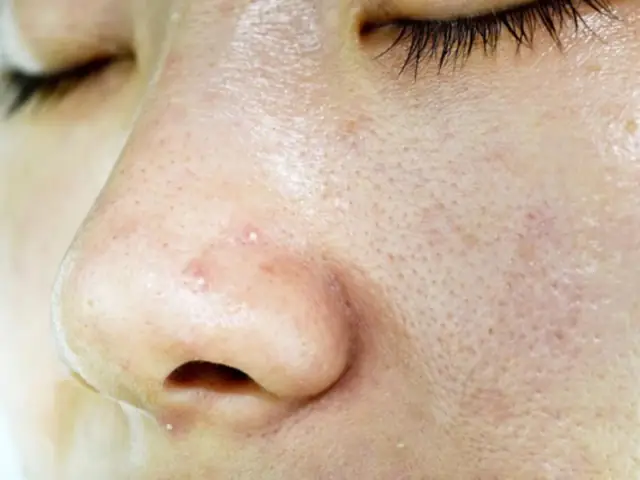 "can't Face" Nghĩa Là Gì? Ý Nghĩa Và Cách Dùng Trong Tiếng Anh
