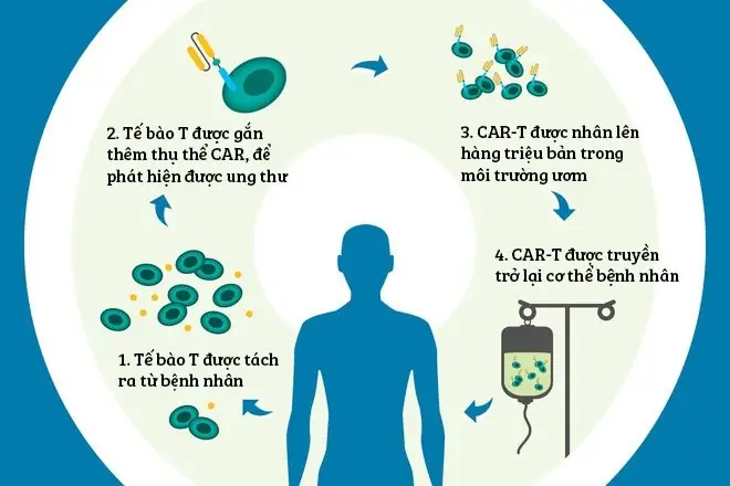 Liệu Pháp CAR-T Là Gì? Cấu Tạo, Quy Trình Và Ứng Dụng Điều Trị Ung Thư Mới Nhất