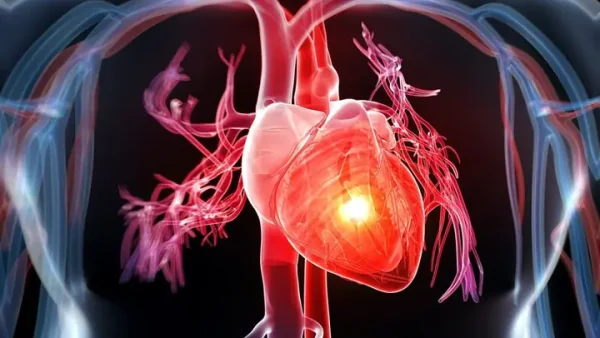 Cardiac Output Là Gì? Định Nghĩa, Công Thức Và Ý Nghĩa Đối Với Sức Khỏe Tim Mạch