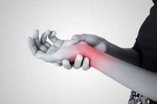 Hội Chứng Ống Cổ Tay (carpal Tunnel Syndrome): Nguyên Nhân, Triệu Chứng, Chẩn Đoán Và Cách Điều Trị Hiệu Quả