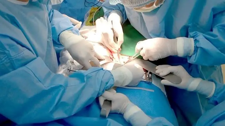 Bệnh Mạch Máu Não (cerebrovascular Disease): Định Nghĩa, Nguyên Nhân, Triệu Chứng Và Phòng Ngừa Toàn Diện
