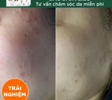 Sữa Rửa Mặt Cetaphil Gentle Skin Cleanser Là Gì? Công Dụng & Cách Dùng Hiệu Quả