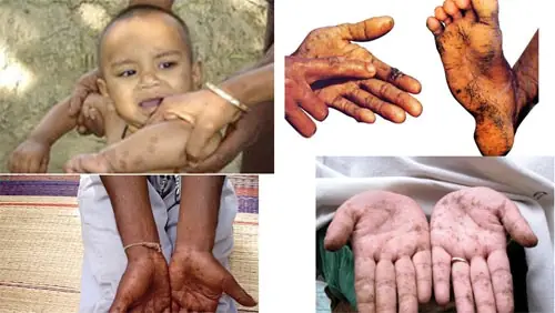 Chì Nước Là Gì? Phân Biệt Với Các Loại Chì Vẽ Khác Và Ứng Dụng Trong Nghệ Thuật Chì Nước Là Gì? Phân Biệt Với Các Loại Chì Vẽ Khác Và Ứng Dụng Trong Nghệ Thuật