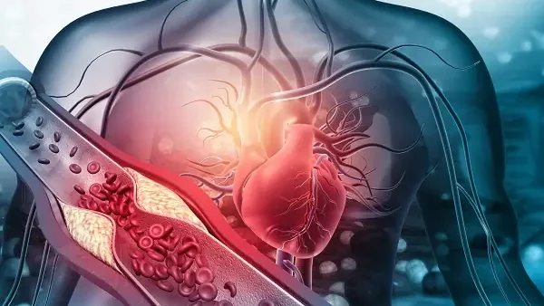 Cholesterol Cobas Là Gì? Giải Đáp Chi Tiết Về Xét Nghiệm Và Ý Nghĩa Chỉ Số
