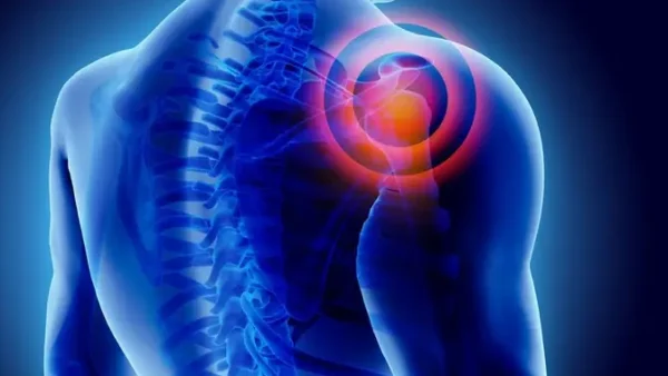 Chronic Nghĩa Là Gì? Giải Thích Chi Tiết Và Ví Dụ Minh Họa