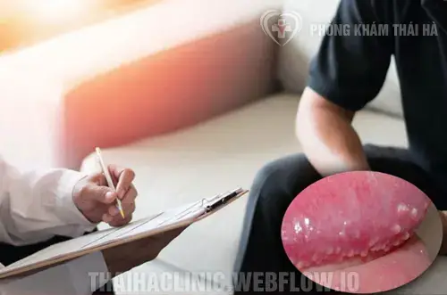 Chuỗi Hạt Ngọc Dương Vật Là Gì? Nguyên Nhân, Triệu Chứng Và Cách Phân Biệt