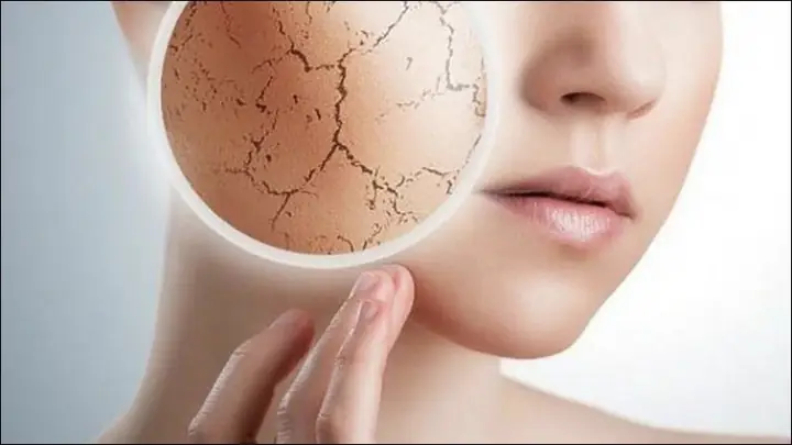 Chuối Tiêu Có Tên Gọi Khác Là Gì? Phân Biệt Các Loại Phổ Biến