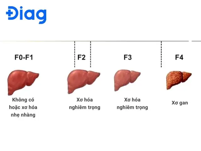 Chuyển Hóa Qua Gan Lần Đầu Là Gì? Giải Thích Chi Tiết Hiệu Ứng Vượt Qua Lần Đầu