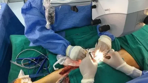 Phẫu Thuật Chuyển Vạt: Khái Niệm, Kỹ Thuật Và Ứng Dụng Y Khoa